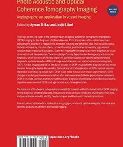 Photo Acoustic and Optical Coherence Tomography Imaging Angiography An Application in Vessel Imaging