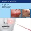 Complications in Minimally Invasive Facial Rejuvenation Prevention and Management