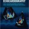 Pocket Guide to Echocardiography