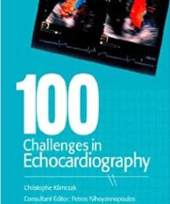 100 Challenges in Echocardiography