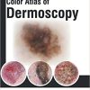 Colour Atlas of Dermoscopy