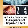 A Practical Guide to the Management of Impacted Teeth
