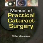 Manual of Practical Cataract Surgery