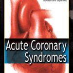Acute Coronary Syndromes By Eric J Topol
