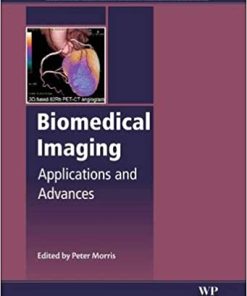 Biomedical Imaging Applications and Advances
