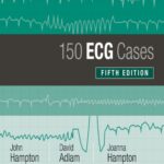 150 ECG Cases 5th Ed By John R Hampton