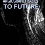 Magnetic Resonance Angiography Basics to Future