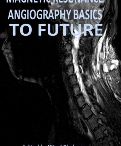 Magnetic Resonance Angiography Basics to Future