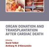 Organ Donation and Transplantation after Cardiac Death