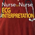 Nurse to Nurse ECG Interpretation
