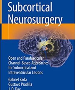 Subcortical Neurosurgery Open and Parafascicular Channel Based Approaches for Subcortical and Intraventricular Lesions