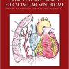 The Complete Reference for Scimitar Syndrome Anatomy Epidemiology Diagnosis and Treatment
