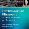 Cerebrovascular Ultrasound in Stroke Prevention and Treatment 2nd Edition
