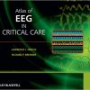 Atlas of EEG in Critical Care