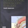 Complications of Gynecologic Endoscopic Surgery