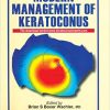 Modern Management of Keratoconus