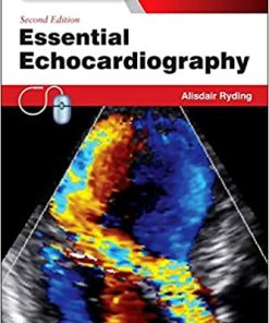 Essential Echocardiography By Alisdair Ryding