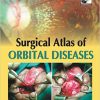 Surgical Atlas of Orbital Diseases