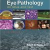 Eye Pathology An Atlas and Text 3rd Ed