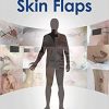 Making Decisions and Avoiding Complications in Skin Flaps