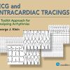 ECG and Intracardiac Tracings A Toolkit Approach for Analyzing Arrhythmias