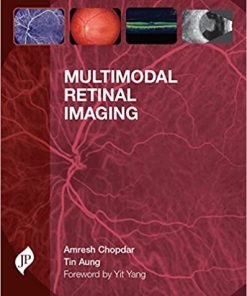 Multimodal Retinal Imaging