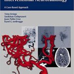 Neurovascular Anatomy in Interventional Neuroradiology A Case Based Approach