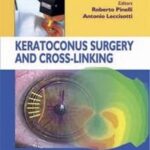 Keratoconus Surgery and Cross linking