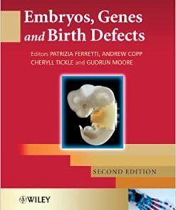Embryos Genes and Birth Defects 2nd Edition