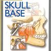Surgery of the Skull Base By Paul J Donald