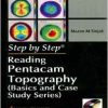 Step By Step Reading Pentacam Topography