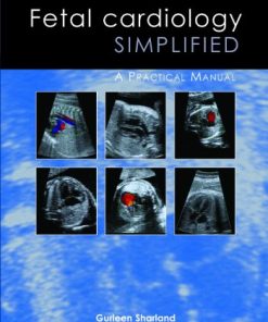 Fetal Cardiology Simplified A Practical Manual