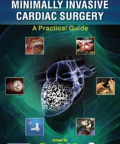 Minimally Invasive Cardiac Surgery A Practical Guide