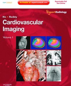 Cardiovascular Imaging
