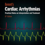 Bennetts Cardiac Arrhythmias Practical Notes on Interpretation and Treatment 8th Edition