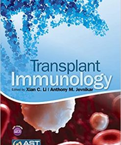 Transplant Immunology