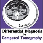 Differential Diagnosis in Computed Tomography 2nd Edition