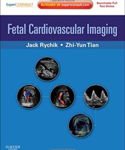 Fetal Cardiovascular Imaging A Disease Based Approach