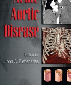 Acute Aortic Disease