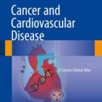 Cancer and Cardiovascular Disease A Concise Clinical Atlas