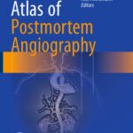 Atlas of Postmortem Angiography