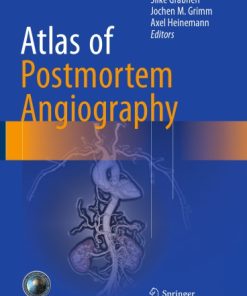 Atlas of Postmortem Angiography