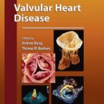 Valvular Heart Disease Contemporary Cardiology