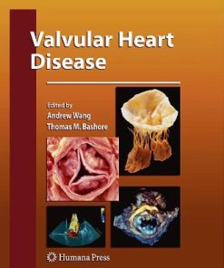 Valvular Heart Disease Contemporary Cardiology