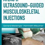 Atlas of Ultrasound Guided Musculoskeletal Injections By Gerard Malanga