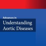 Advances in Understanding Aortic Diseases