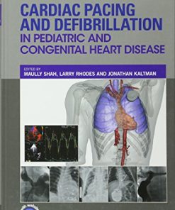 Cardiac Pacing and Defibrillation in Pediatric and Congenital Heart Disease