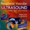 Peripheral Vascular Ultrasound How Why and When 2nd Edition