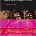Basic Electrocardiography Normal and Abnormal ECG Patterns deLuna