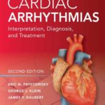 Cardiac Arrhythmias Interpretation Diagnosis and Treatment 2nd Edition